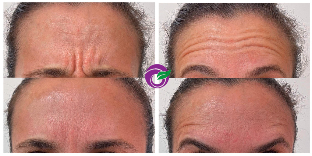 بهترین دکتر ژل و بوتاکس در شیراز