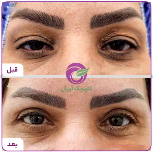 بهترین دکتر جراح پلک