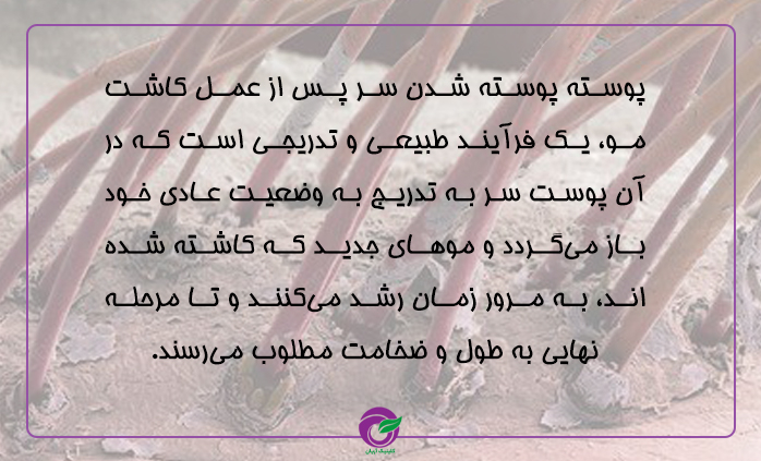 پوسته پوسته شدن سر پس از عمل کاشت مو، یک فرآیند طبیعی است