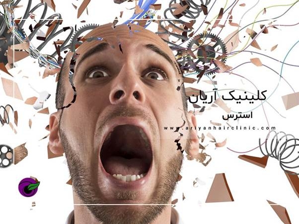 تاثیر استرس در ریزش مو