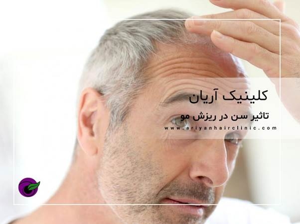 تاثیر سن در ریزش مو