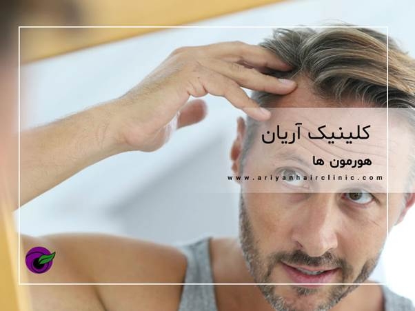 تاثیر هورمون ها در ریزش مو