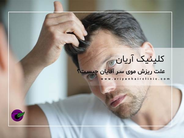 علت ریزش موی سر آقایان چیست؟