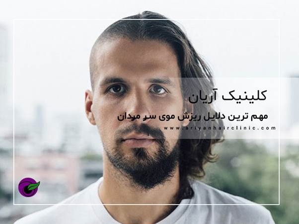 مهم ترین دلایل ریزش موی سر مردان