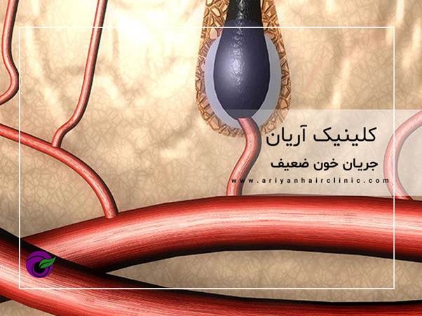 نمای شماتیک فولیکول و رگ های اطراف آن
