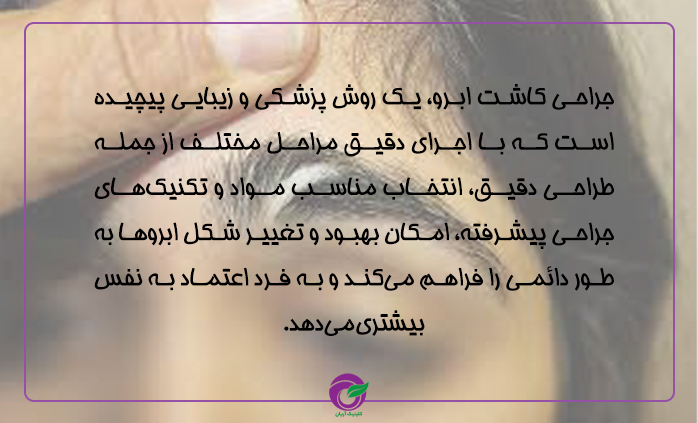 جراحی کاشت ابرو