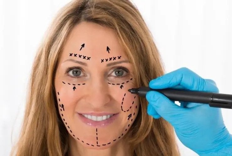 التجهیز لعملیة تجمیل الوجه