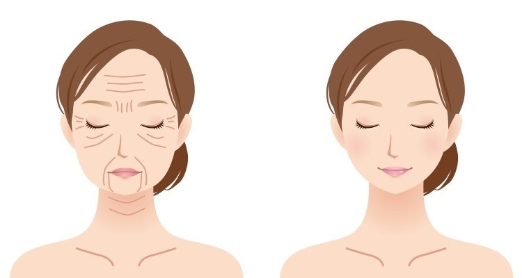 رسومات قبل و بعد ازالة تجاعید الوجه