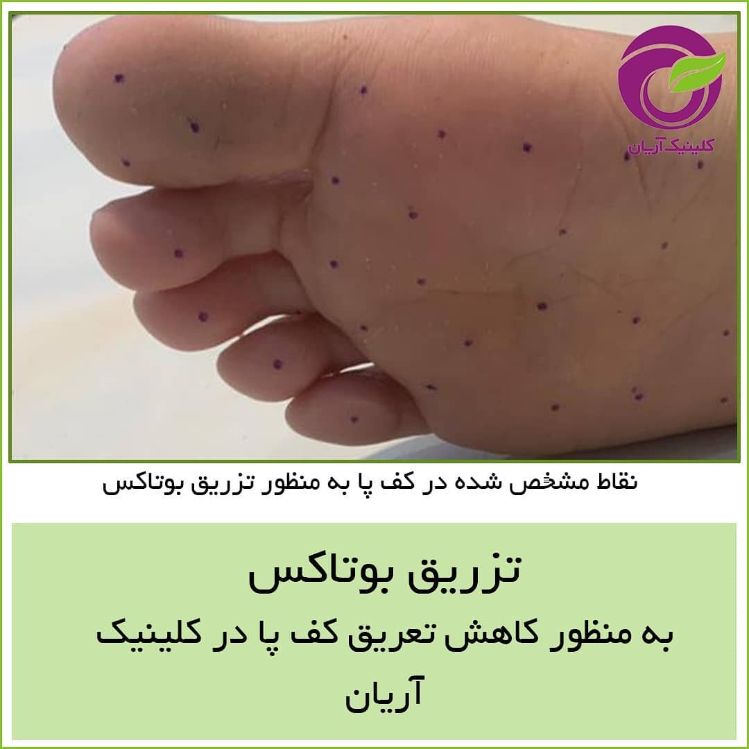 تصاویر قبل و بعد از تزریق ژل