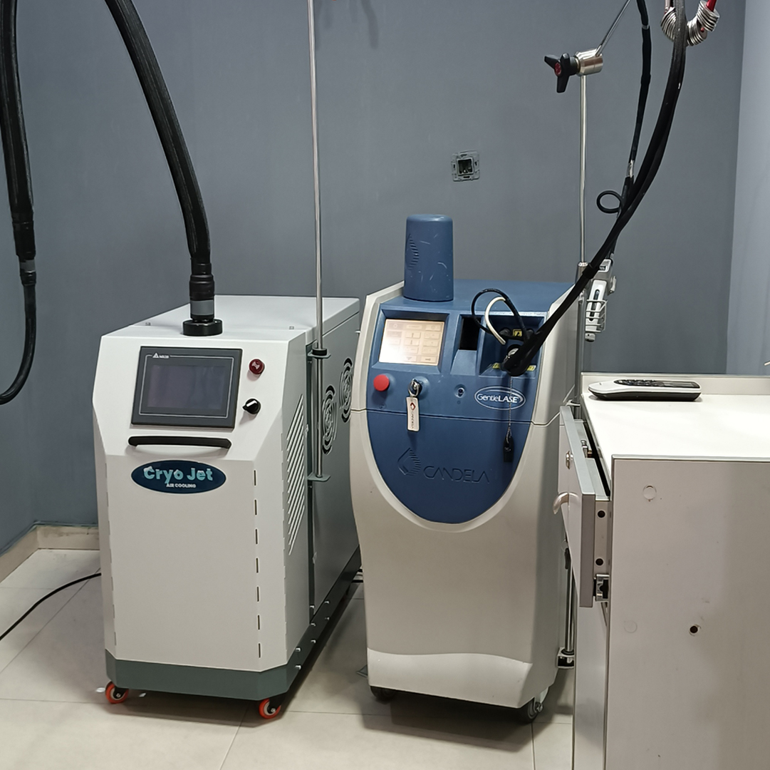 لیزر مو های زائد