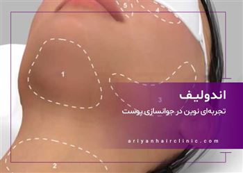 گالری اندولیفت