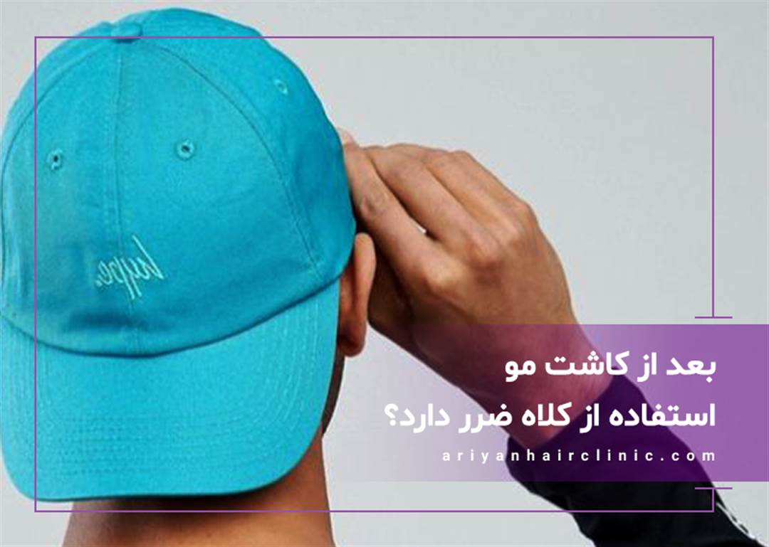 آیا استفاده از کلاه بعد از کاشت مو ضرر دارد؟