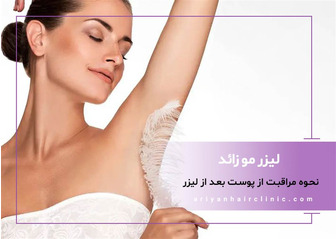 مراقبت از پوست بعد از لیزر مو زائد