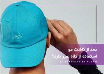 آیا استفاده از کلاه بعد از کاشت مو ضرر دارد؟
