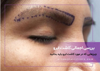 بررسی اجمالی جراحی کاشت ابرو