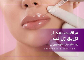 مراقبت بعد از تزریق ژل لب