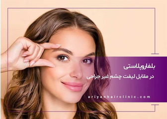 بلفاروپلاستی یا لیفت چشم غیر جراحی ؟