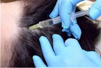 What is PRP therapy؟