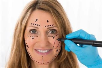 عملية شد الوجه