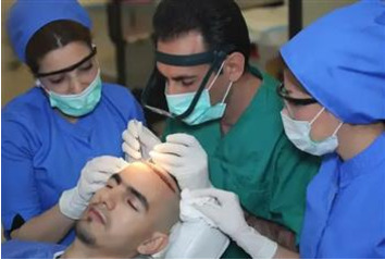 FUE Hair Transplant
