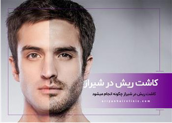 کاشت ریش و سبیل - شیراز