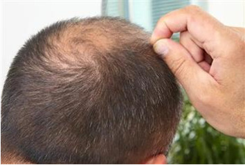 بانک مو چیست و چه کاربردی دارد؟