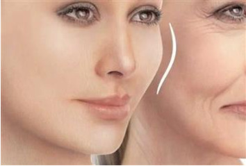 سوالات رایج لیفت با نخ