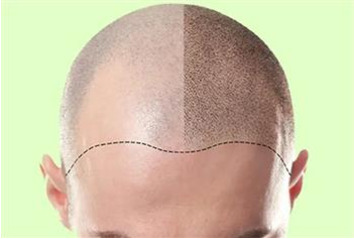 Preoperative recommendations