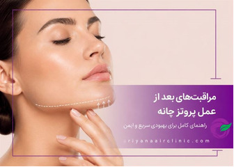 مراقبت‌های بعد از عمل پروتز چانه