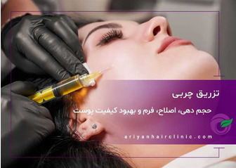تزریق چربی در شیراز
