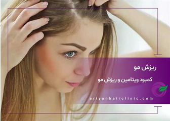 کمبود ویتامین و ریزش مو
