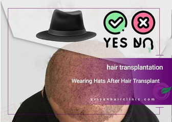 Does Wearing a Hat After Hair Transplant Cause Harm?