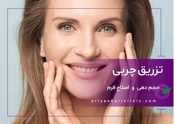 تزریق چربی در شیراز