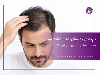 چرا یک سال بعد از کاشت مو دوباره موها کم‌پشت می‌شوند؟