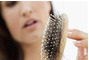 Hair Loss