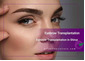Eyebrow Transplantation in Shiraz
