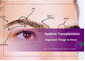 Important Things to Know Before Eyebrow Transplantation