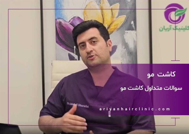 سوالات متداول کاشت مو