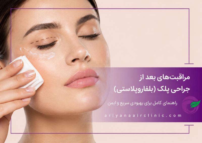 مراقبت‌های بعد از جراحی پلک (بلفاروپلاستی)