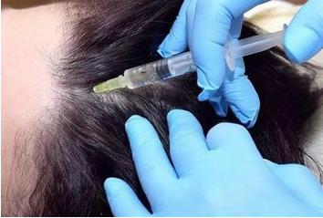 What is PRP therapy؟