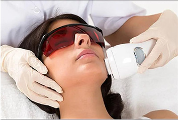 What is laser hair removal?