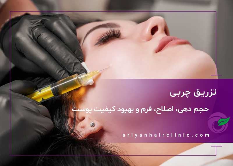 تزریق چربی در شیراز