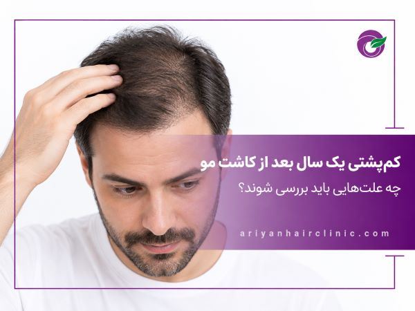 ریزش و کم‌ پشتی مو یک سال بعد از کاشت | علت چیست؟