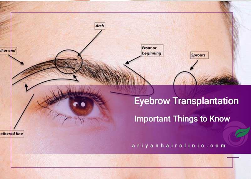Essential Pre-Transplant Checklist for Eyebrow Transplantation