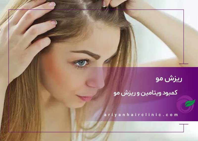 کمبود ویتامین و ریزش مو | بررسی علمی و راهکارهای درمانی