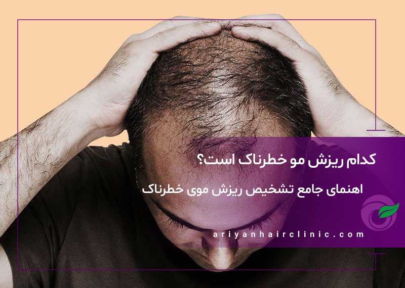 کدام ریزش مو خطرناک است؟ راهنمای جامع تشخیص و درمان