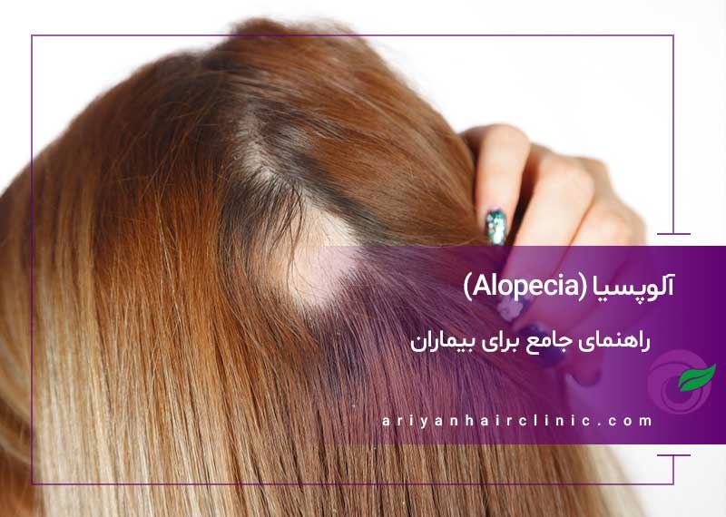 آلوپسی (ریزش مو): راهنمای جامع برای بیماران